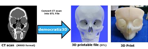 democratiz3d|Easily Convert Medical Scans to 3D Printable Models Dicom to STL.